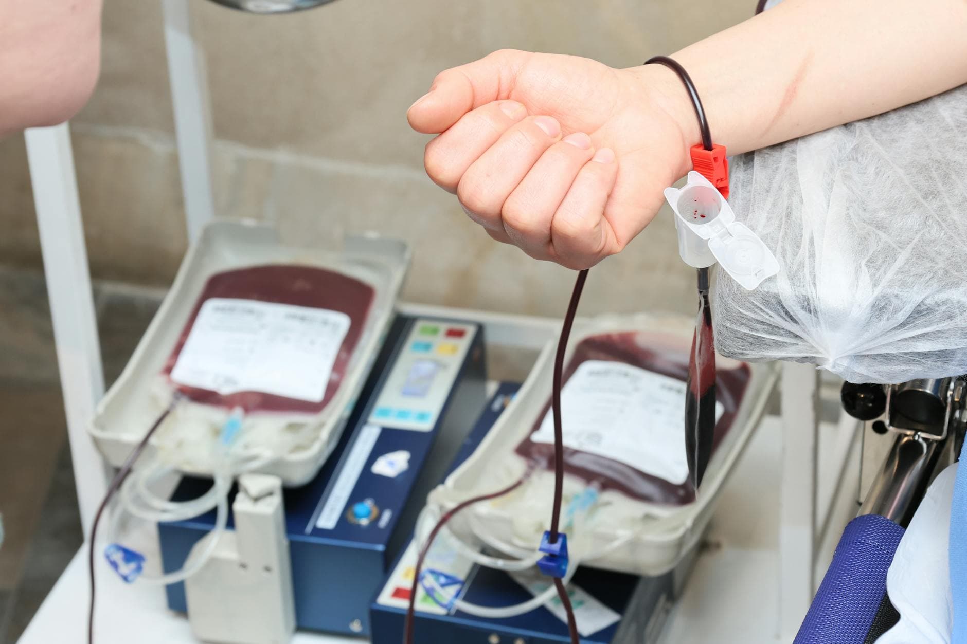 PRP-hoito (Vampyyrihoito): Ihon ja hiusten luonnollinen uudistuminen omilla soluilla