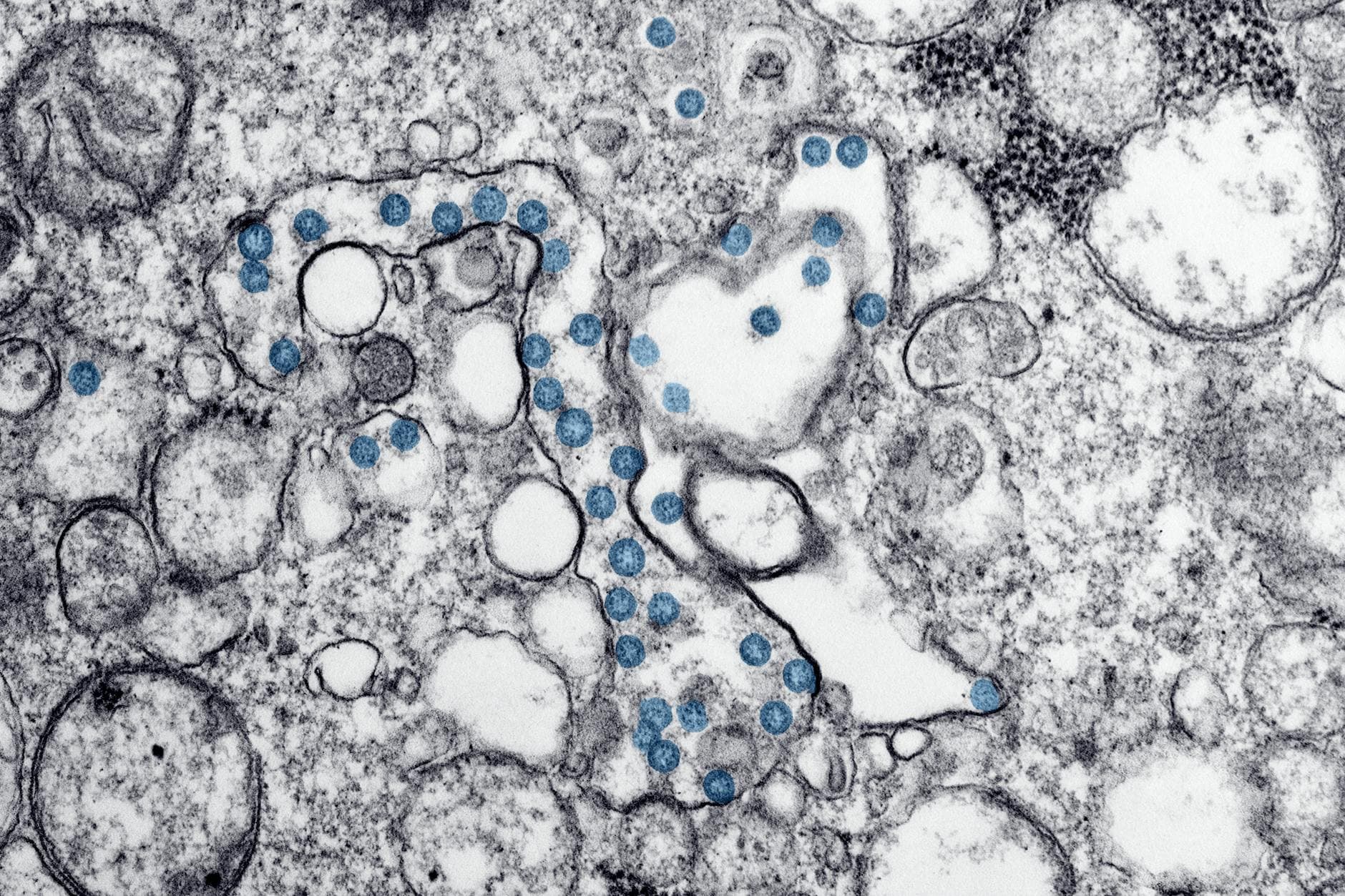 Hantavirus nousi jälleen otsikoihin – mitä tällä viikolla oikein tapahtui?